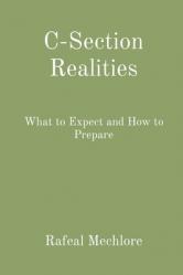  C-Section Realities: What to Expect and How to Prepare 